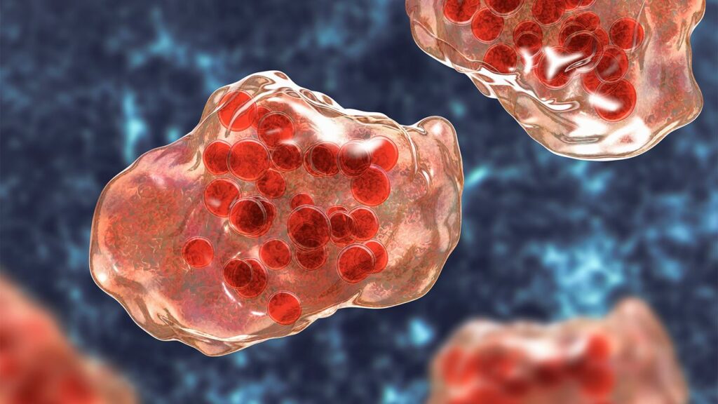 2 people die of measles in Pennsylvania as vaccination rates drop across the nation 2 people die of measles in Pennsylvania as vaccination rates drop across the nation