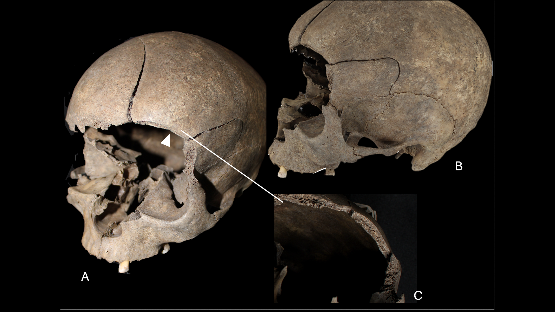 Archaeologists discover a child’s skull built into the floor of a 2,500-year-old Scandinavian house Archaeologists discover a child’s skull built into the floor of a 2,500-year-old Scandinavian house